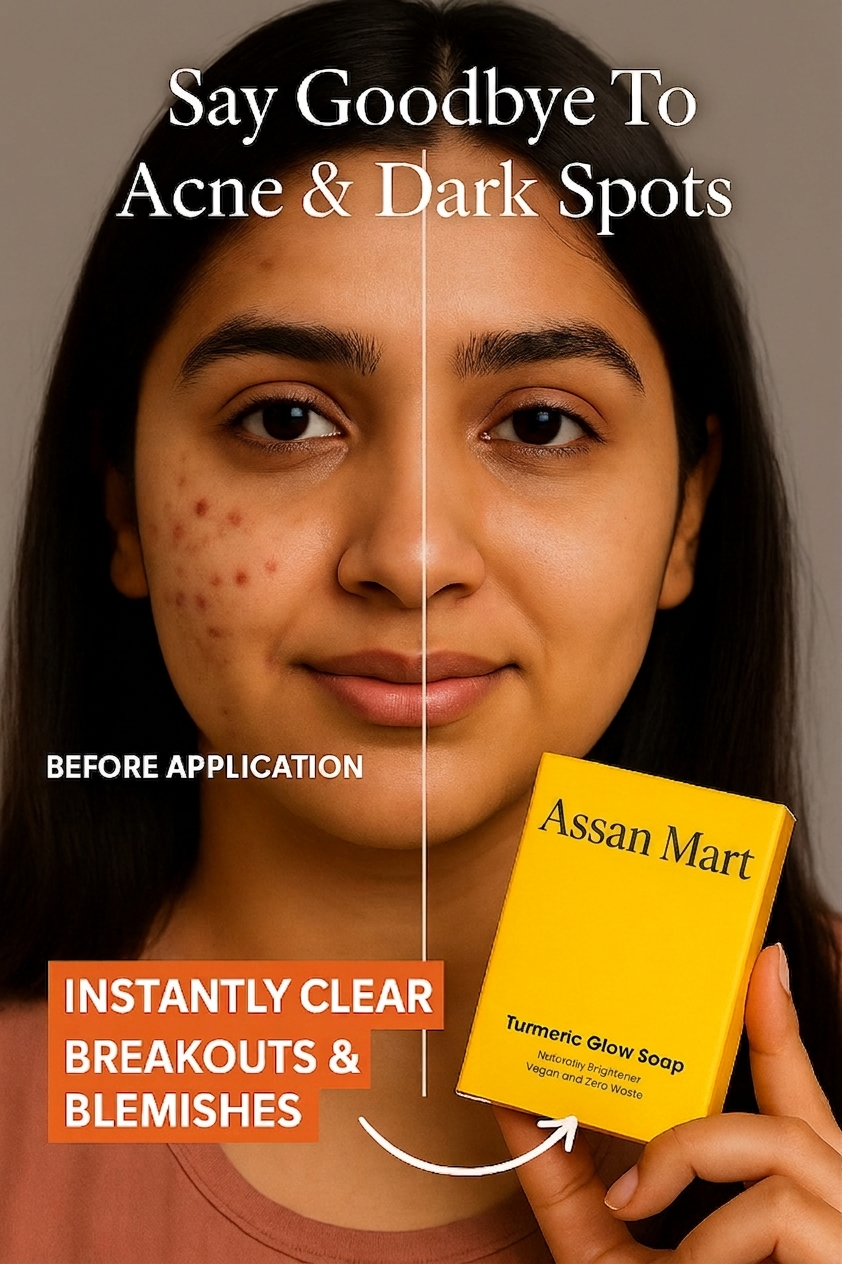 Turmeric & Kojic Acid Soap for Instant Glow