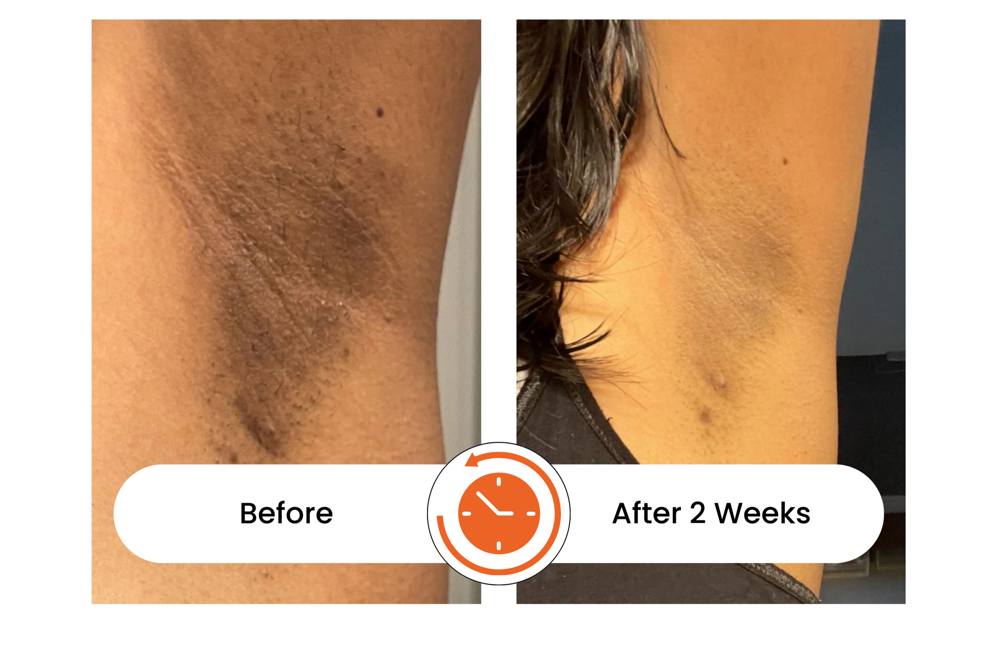 Turmeric & Kojic Acid Soap for Instant Glow