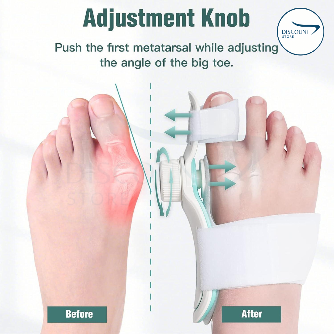 Bunion Toe Corrector – Instant Pain Relief & Realignment While You Walk