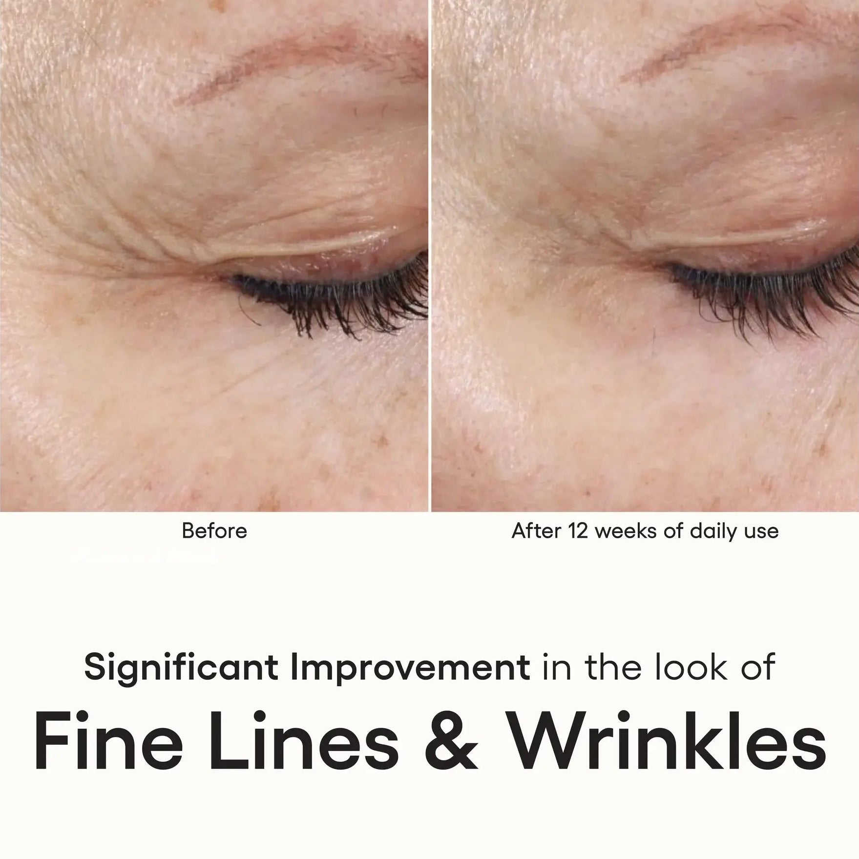 Glow Like Never Before – INTENSE Serum for Radiant, Spotless & Youthful Skin ✨